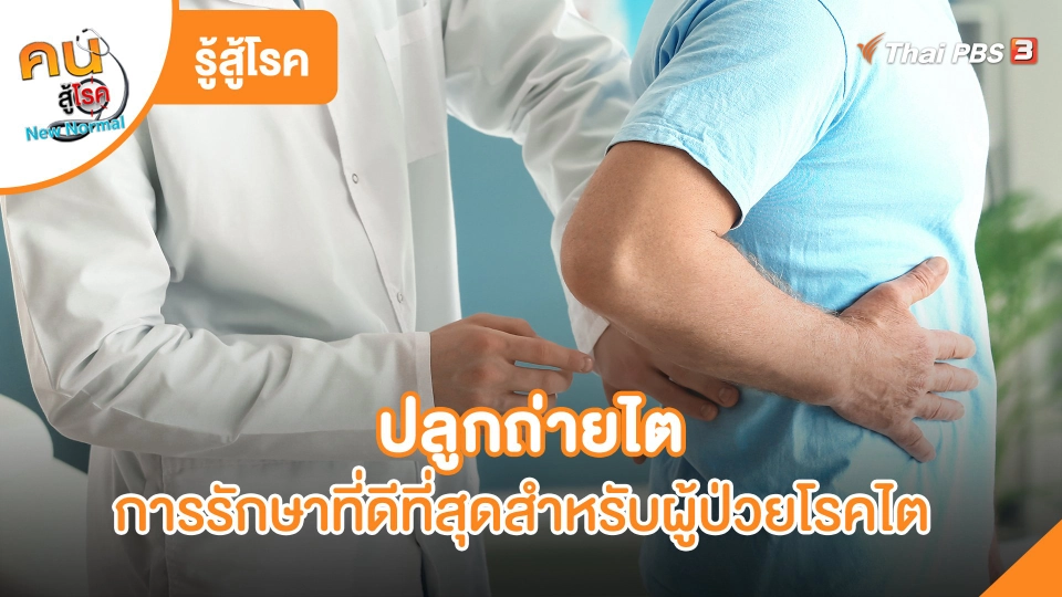 ปลูกถ่ายไต การรักษาที่ดีที่สุดสำหรับผู้ป่วยโรคไต