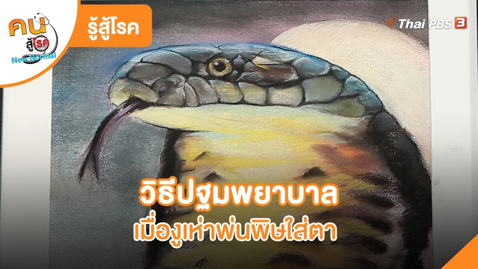 รู้สู้โรค: วิธีปฐมพยาบาล เมื่องูเห่าพ่นพิษใส่ตา