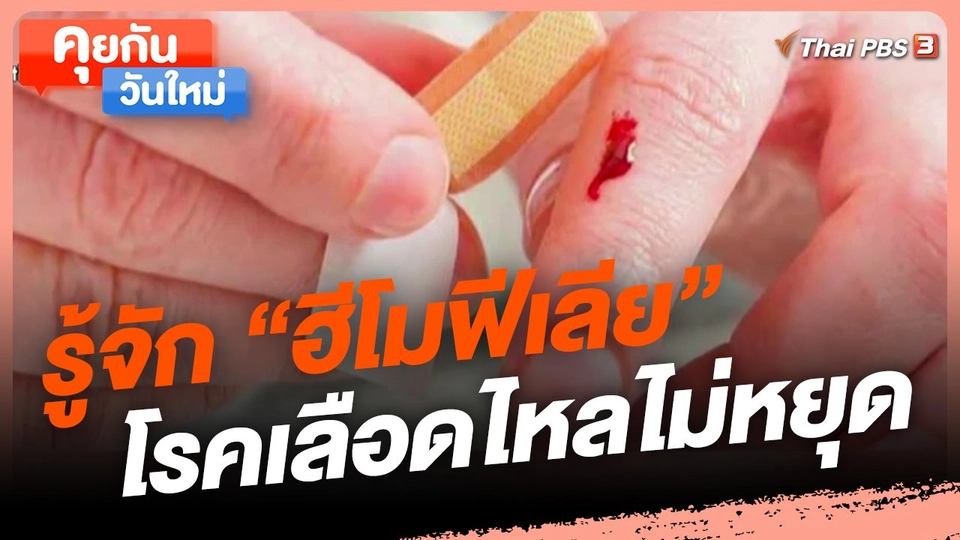 ​คุยกันวันใหม่ : รู้จัก "ฮีโมฟีเลีย" โรคเลือดไหลไม่หยุด
