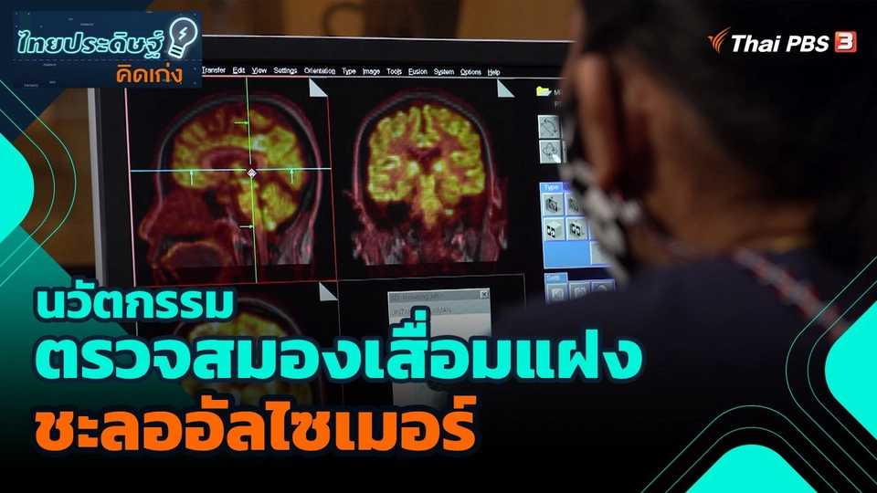 ​ไทยประดิษฐ์คิดเก่ง : นวัตกรรมตรวจสมองเสื่อมแฝง ชะลออัลไซเมอร์