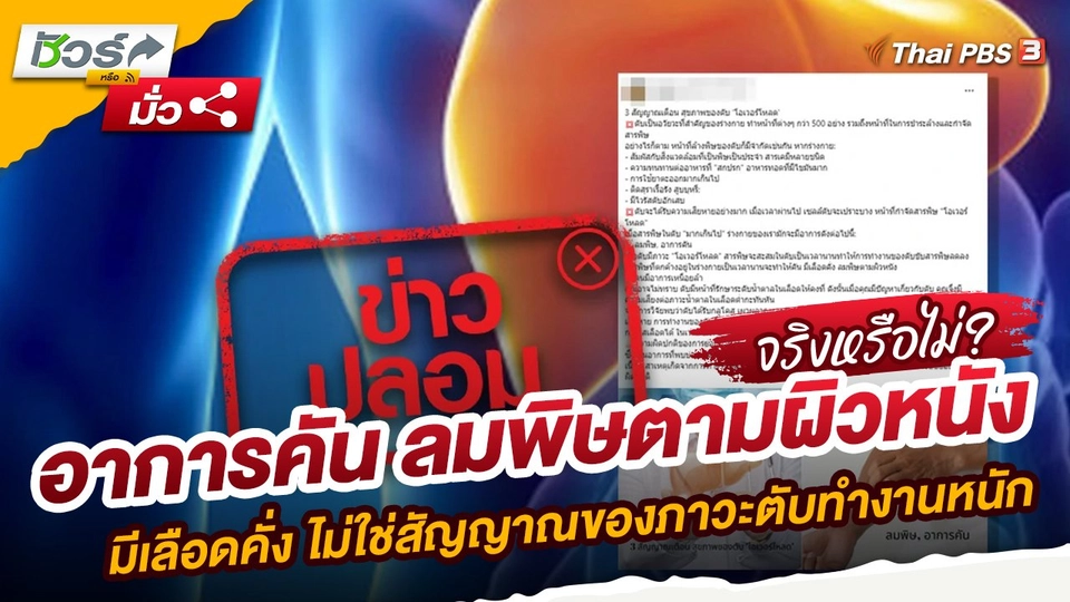 อาการคัน ลมพิษตามผิวหนัง มีเลือดคั่ง ไม่ใช่สัญญาณของภาวะตับทำงานหนัก