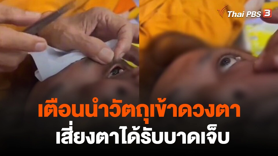 เตือนนำวัตถุเข้าดวงตาเสี่ยงตาได้รับบาดเจ็บ