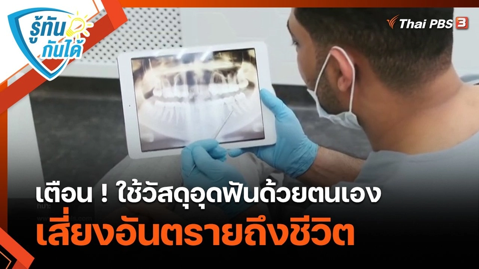 รู้ทันกันได้ : เตือน ! ใช้วัสดุอุดฟันด้วยตนเอง เสี่ยงอันตรายถึงชีวิต