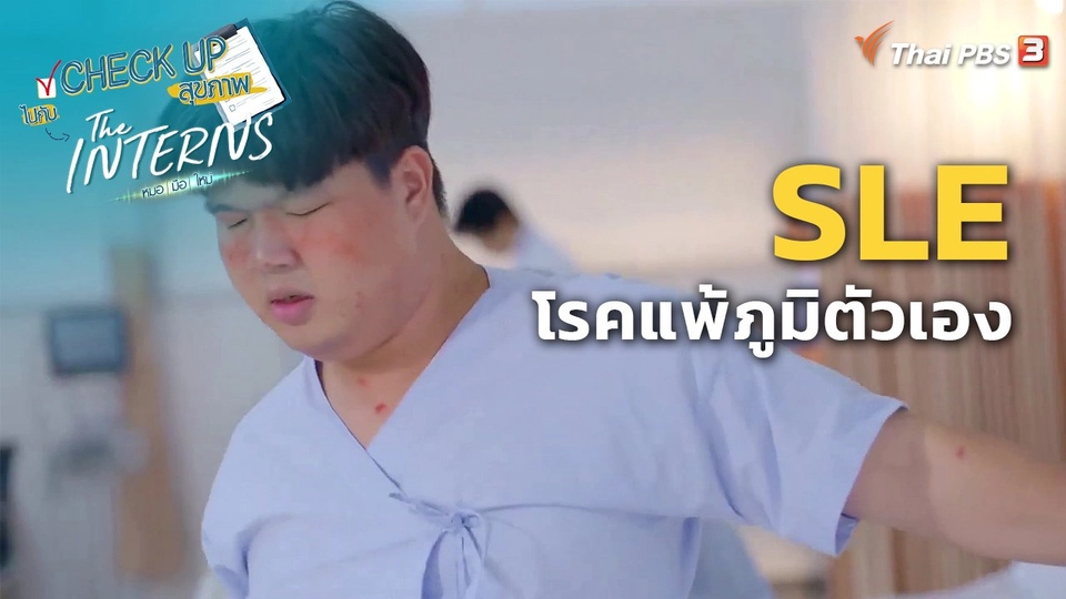 ​CHECK UP สุขภาพ : SLE หรือ โรคแพ้ภูมิตัวเอง