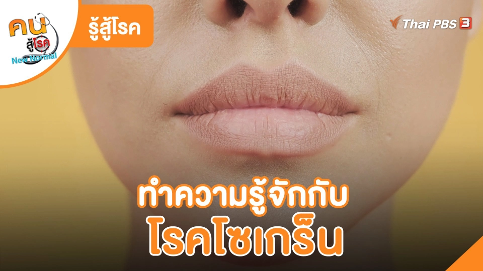 ​รู้รู้สู้โรค : ทำความรู้จักกับโรคโซเกร็น