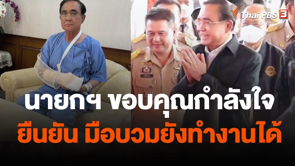 นายกฯ ขอบคุณกำลังใจ ยืนยัน มือบวมยังทำงานได้