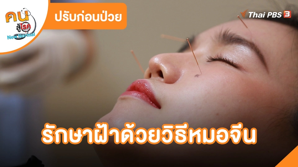 รักษาฝ้าด้วยวิธีหมอจีน