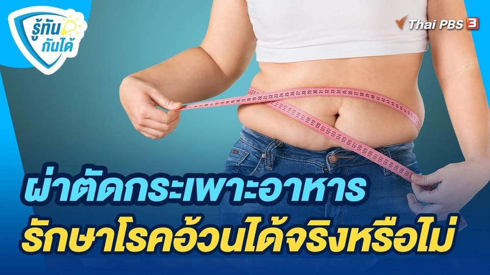 รู้ทันกันได้ : ผ่าตัดกระเพาะอาหาร รักษาโรคอ้วนได้จริงหรือไม่
