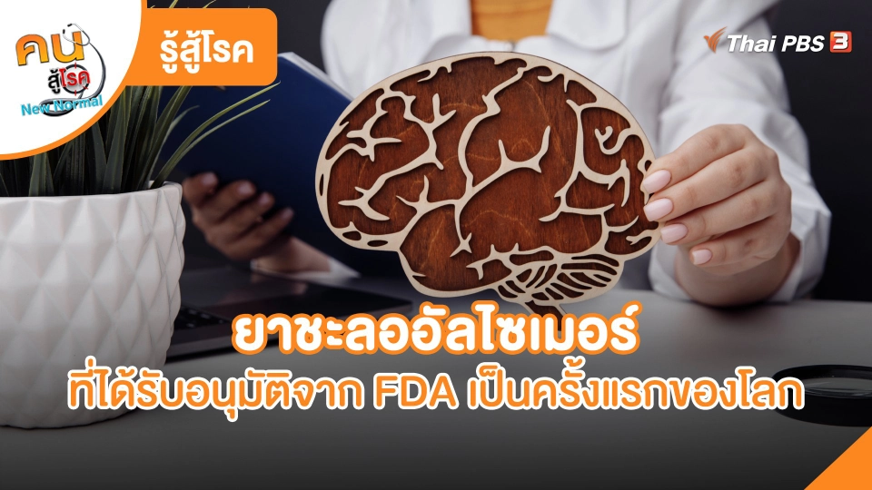 ​รู้สู้โรค : ยาชะลออัลไซเมอร์ที่ได้รับอนุมัติจาก FDA เป็นครั้งแรกของโลก