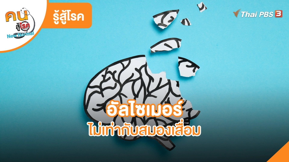 รู้สู้โรค : อัลไซเมอร์ไม่เท่ากับสมองเสื่อม