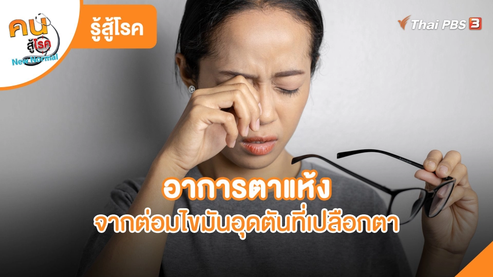 ​รู้สู้โรค : อาการตาแห้งจากต่อมไขมันอุดตันที่เปลือกตา