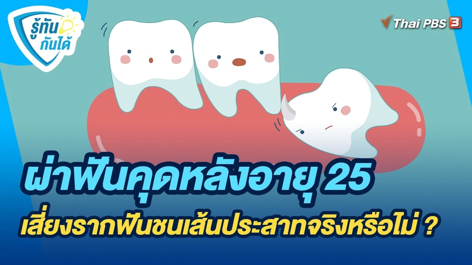 รู้ทันกันได้ : ผ่าฟันคุดหลังอายุ 25 เสี่ยงรากฟันชนเส้นประสาทจริงหรือไม่ ?