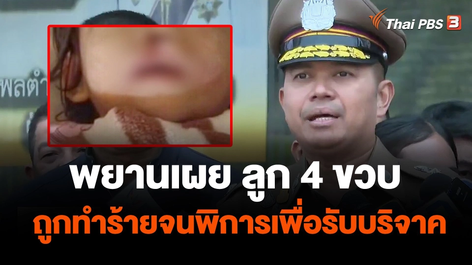 พยานเผย ลูก 4 ขวบ ถูกทำร้ายจนพิการเพื่อรับบริจาค