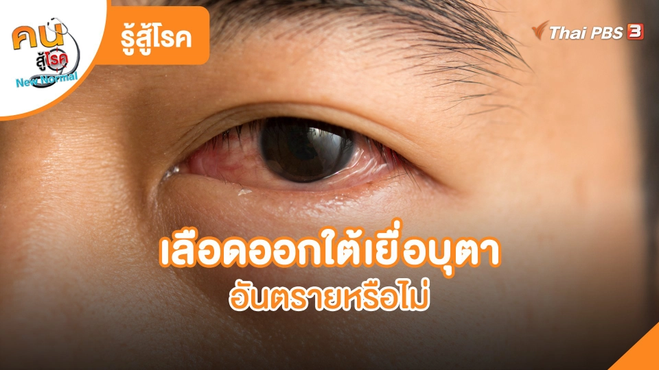 เลือดออกใต้เยื่อบุตาอันตรายหรือไม่