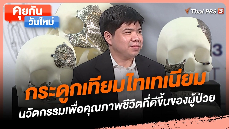 กระดูกเทียมไทเทเนียม นวัตกรรมเพื่อคุณภาพชีวิตที่ดีขึ้นของผู้ป่วย