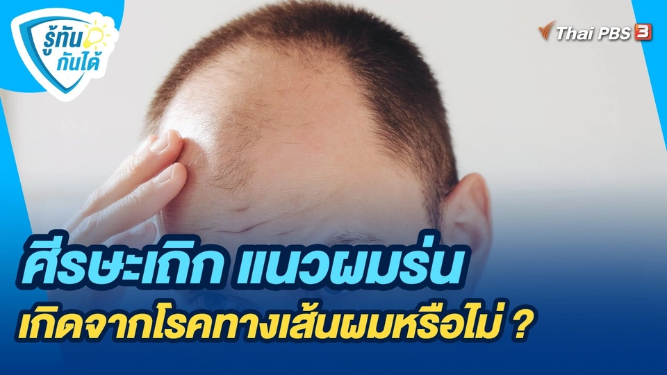 ศีรษะเถิก แนวผมร่น เกิดจากโรคทางเส้นผมหรือไม่ ?