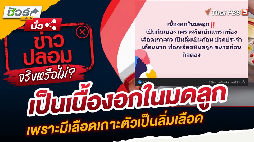 ชัวร์หรือมั่ว : เป็นเนื้องอกในมดลูก เพราะมีเลือดเกาะตัวเป็นลิ่มเลือด