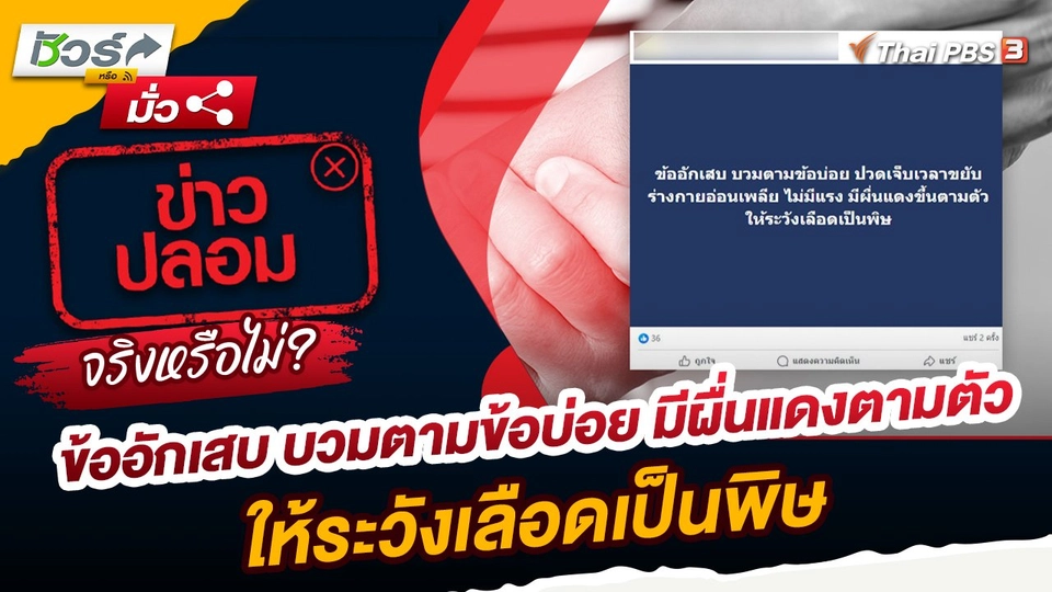 ชัวร์หรือมั่ว : ข้ออักเสบ บวมตามข้อบ่อย มีผื่นแดงตามตัว ให้ระวังเลือดเป็นพิษ จริงหรือไม่ ?