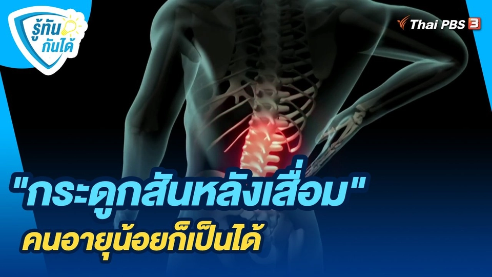 "กระดูกสันหลังเสื่อม" คนอายุน้อยก็เป็นได้