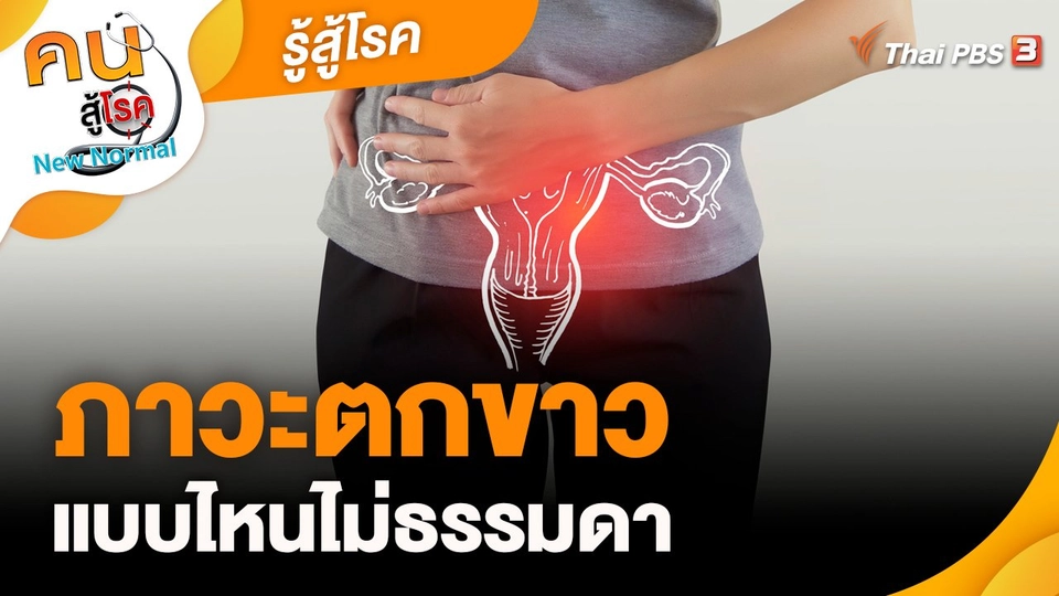 รู้สู้โรค : ภาวะตกขาวแบบไหนไม่ธรรมดา