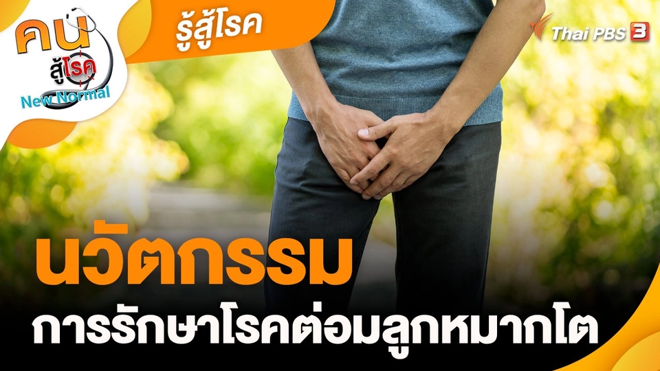 รู้สู้โรค : นวัตกรรมในการรักษาโรคต่อมลูกหมากโต