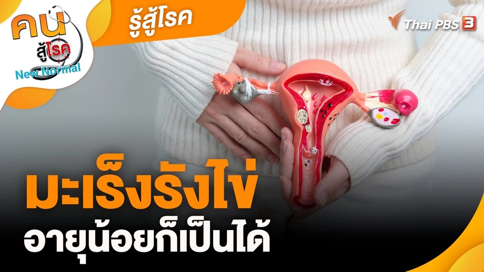 ​รู้สู้โรค : มะเร็งรังไข่อายุน้อยก็เป็นได้