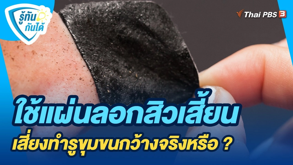 รู้ทันกันได้ : ใช้แผ่นลอกสิวเสี้ยน เสี่ยงทำรูขุมขนกว้างจริงหรือ ?