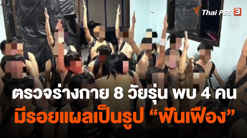 ตรวจร่างกาย 8 วัยรุ่น พบ 4 คนมีรอยแผลเป็นรูป "ฟันเฟือง"