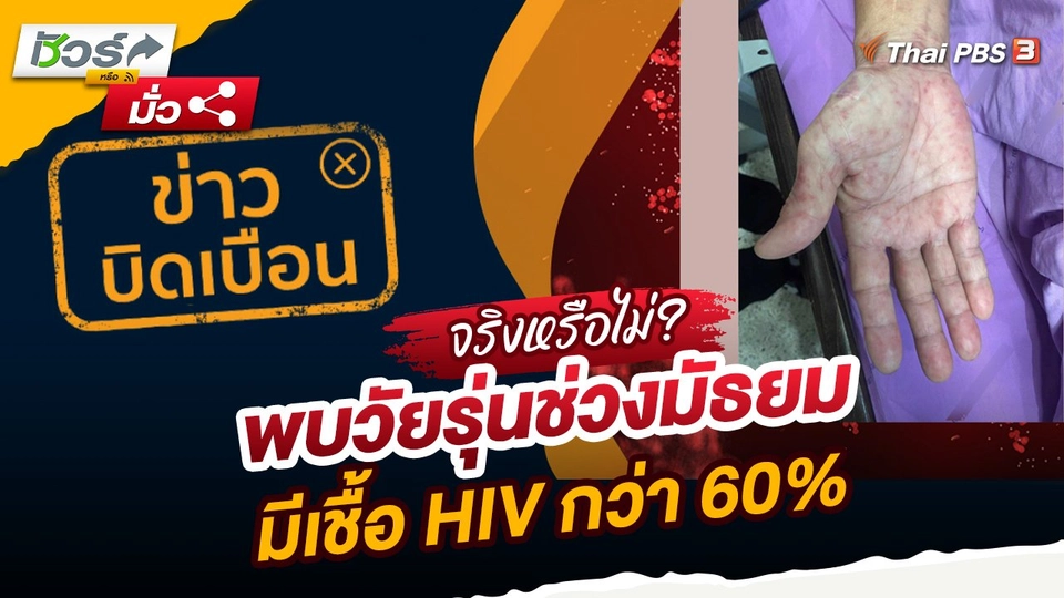 ชัวร์หรือมั่ว : ข่าวปลอม!! พบวัยรุ่นช่วงมัธยมมีเชื้อ HIV กว่า 60%