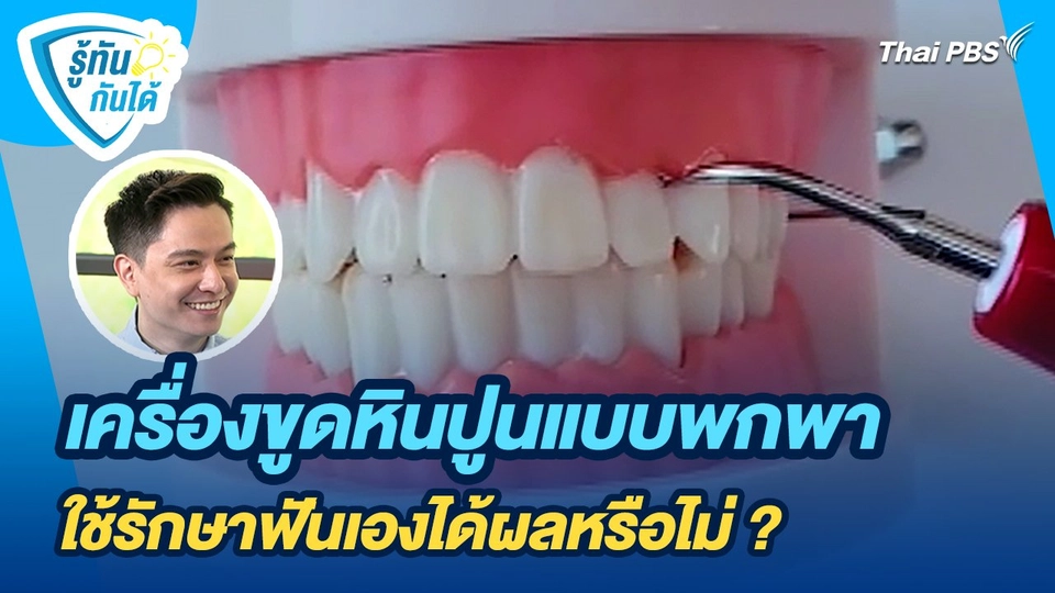 รู้ทันกันได้ : เครื่องขูดหินปูนแบบพกพา ใช้รักษาฟันเองได้ผลหรือไม่ ?