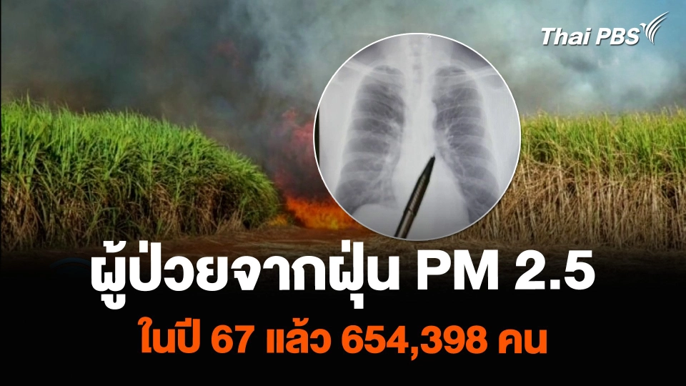 สธ.พบผู้ป่วยจากฝุ่น PM 2.5 ในปี 67 แล้ว 654,398 คน