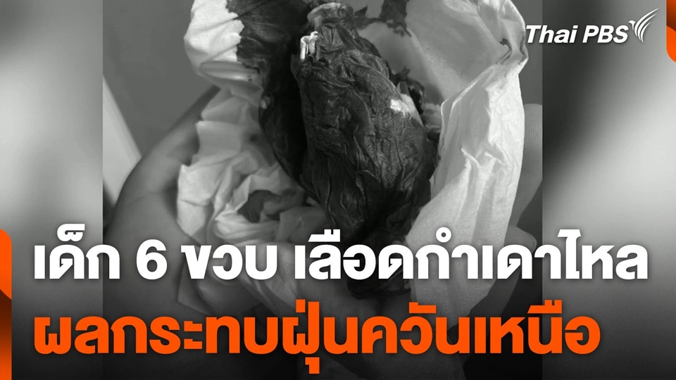 เด็ก 6 ขวบเลือดกำเดาไหล ผลกระทบฝุ่นควันเหนือ