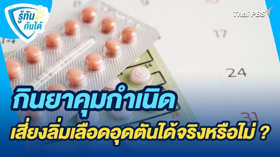 รู้ทันกันได้ : กินยาคุมกำเนิดเสี่ยงลิ่มเลือดอุดตันได้จริงหรือไม่ ?