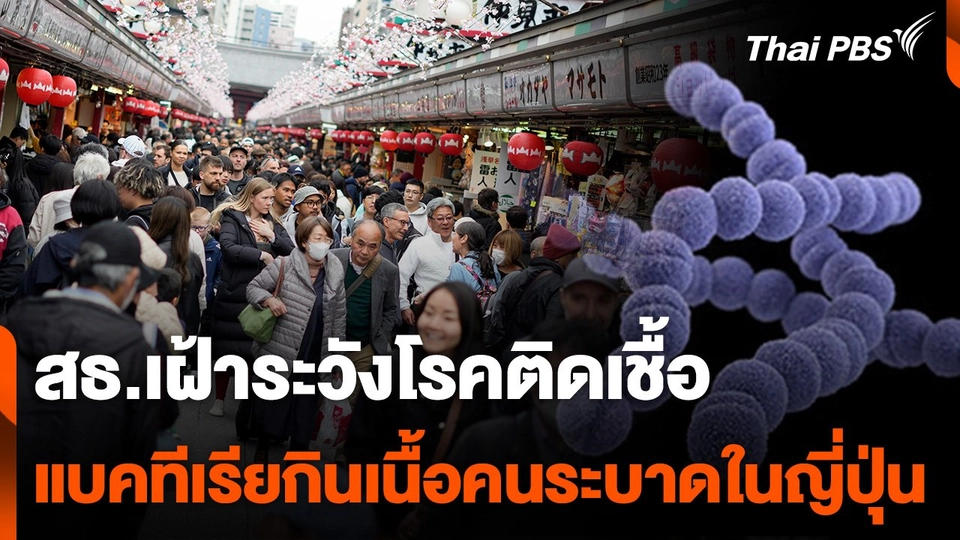 สธ.เฝ้าระวังโรคติดเชื้อ "สเตรปโตคอคคัส" ระบาดในญี่ปุ่น