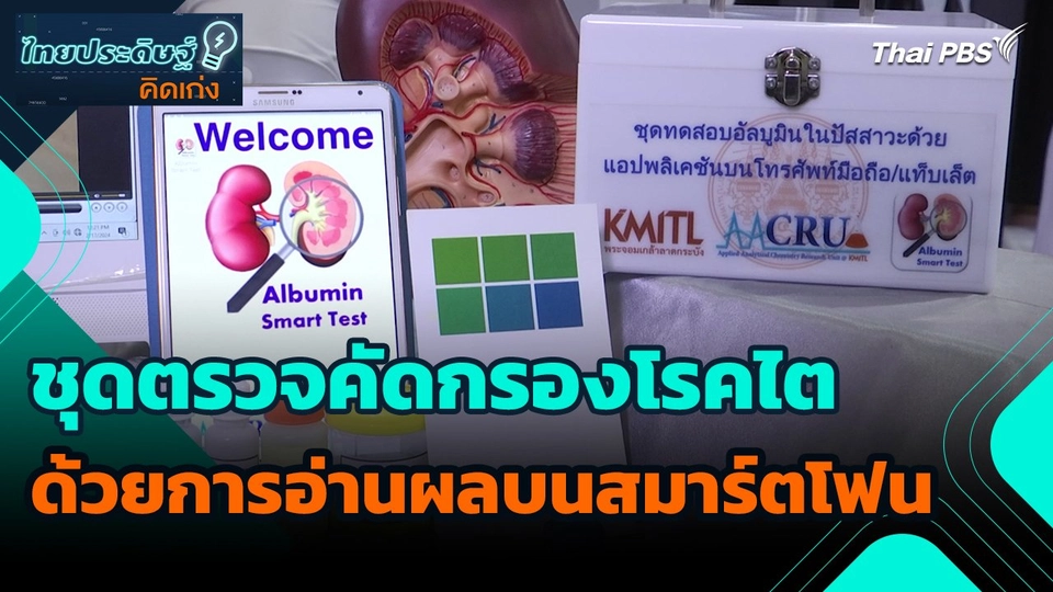 ไทยประดิษฐ์คิดเก่ง : ชุดตรวจคัดกรองโรคไตด้วยการอ่านผลบนสมาร์ตโฟน