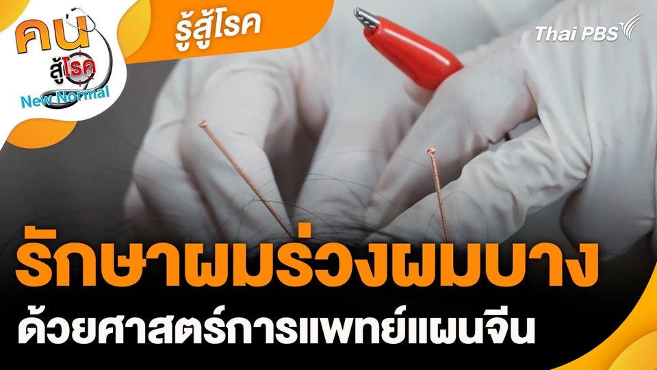 รู้สู้โรค : รักษาผมร่วงผมบางด้วยศาสตร์การแพทย์แผนจีน