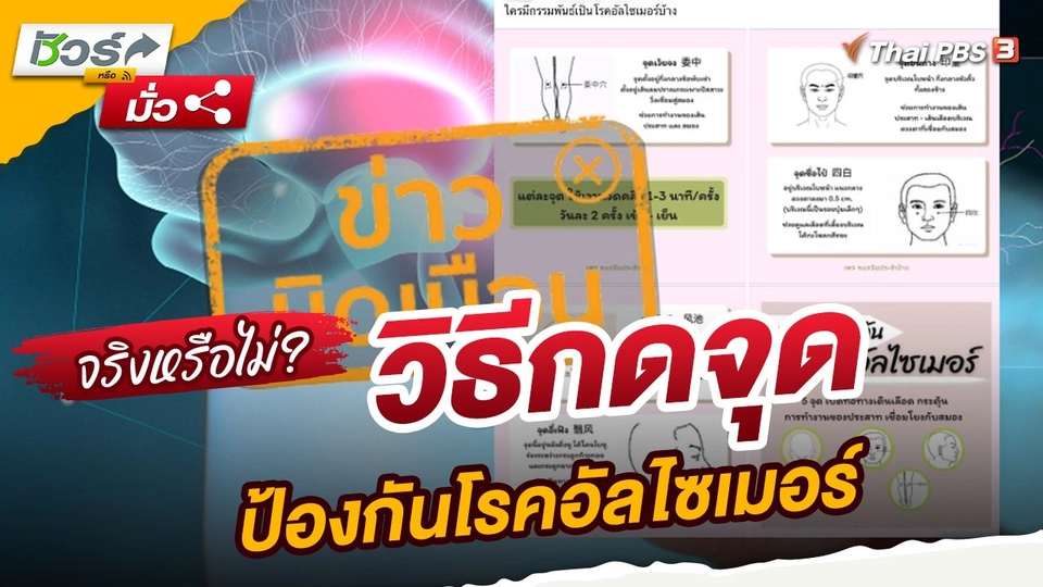 ​ชัวร์หรือมั่ว : ข่าวบิดเบือน !! วิธีกดจุดป้องกันโรคอัลไซเมอร์