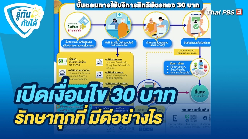 รู้ทันกันได้ : เปิดเงื่อนไข 30 บาท รักษาทุกที่ มีดีอย่างไร