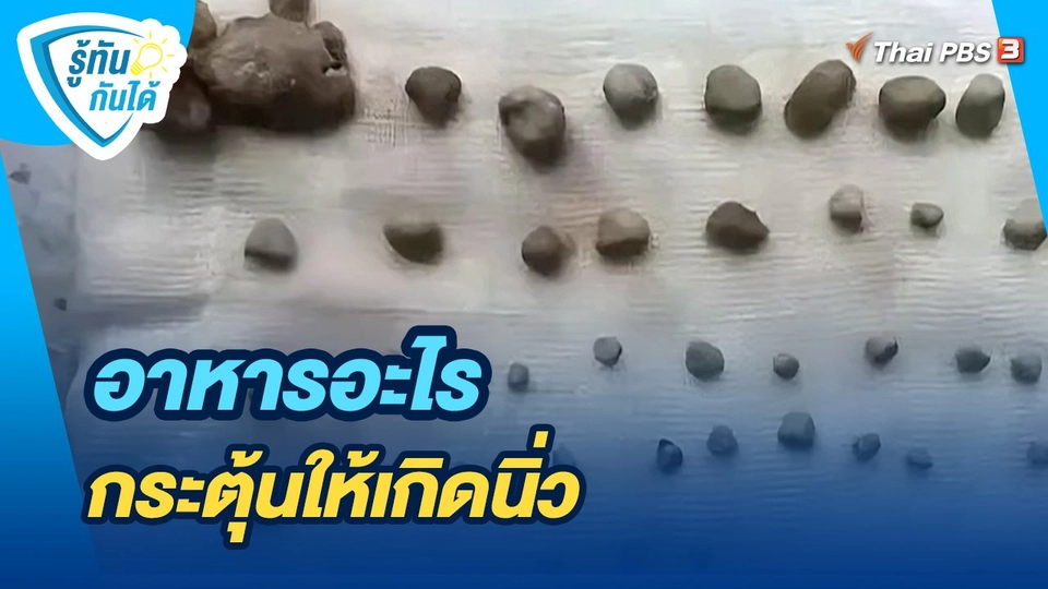 รู้ทันกันได้ :  อาหารอะไร กระตุ้นให้เกิดนิ่ว