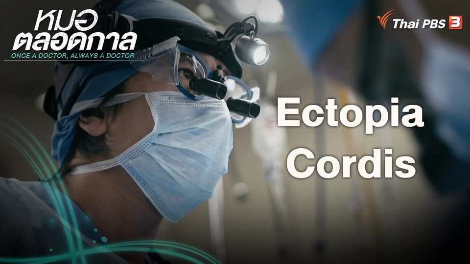 ​Ectopia Cordis