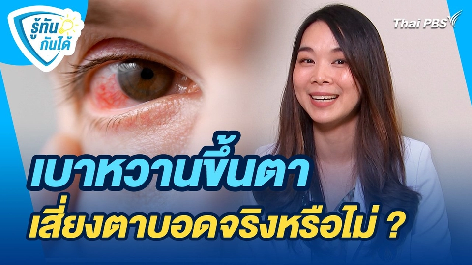 รู้ทันกันได้ : เบาหวานขึ้นตาเสี่ยงตาบอดจริงหรือไม่ ?