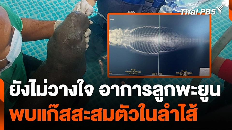 ทีมสัตวแพทย์ฯ ยังไม่วางใจอาการลูกพะยูนพลัดหลงกับแม่
