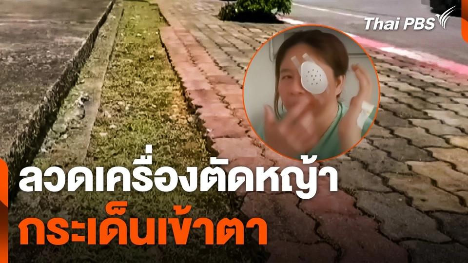 ลวดเครื่องตัดหญ้ากระเด็นเข้าตา