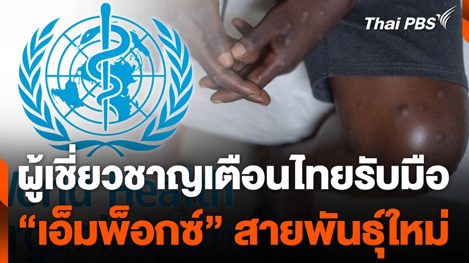 ผู้เชี่ยวชาญเตือนไทยรับมือ "โรคเอ็มพ็อกซ์" สายพันธุ์ใหม่