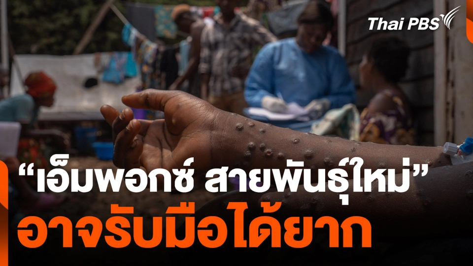 "เอ็มพอกซ์ สายพันธุ์ใหม่" อาจรับมือได้ยาก