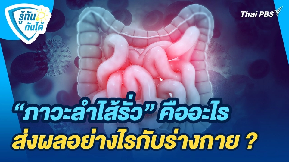 รู้ทันกันได้ : "ภาวะลำไส้รั่ว" คืออะไร ส่งผลอย่างไรกับร่างกาย ?