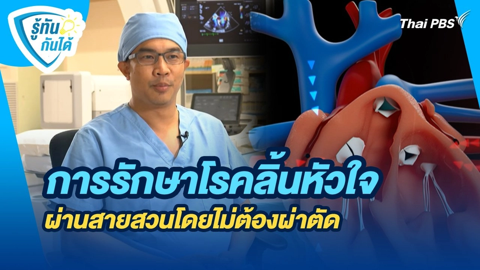 รู้ทันกันได้ : การรักษาโรคลิ้นหัวใจผ่านสายสวนโดยไม่ต้องผ่าตัด