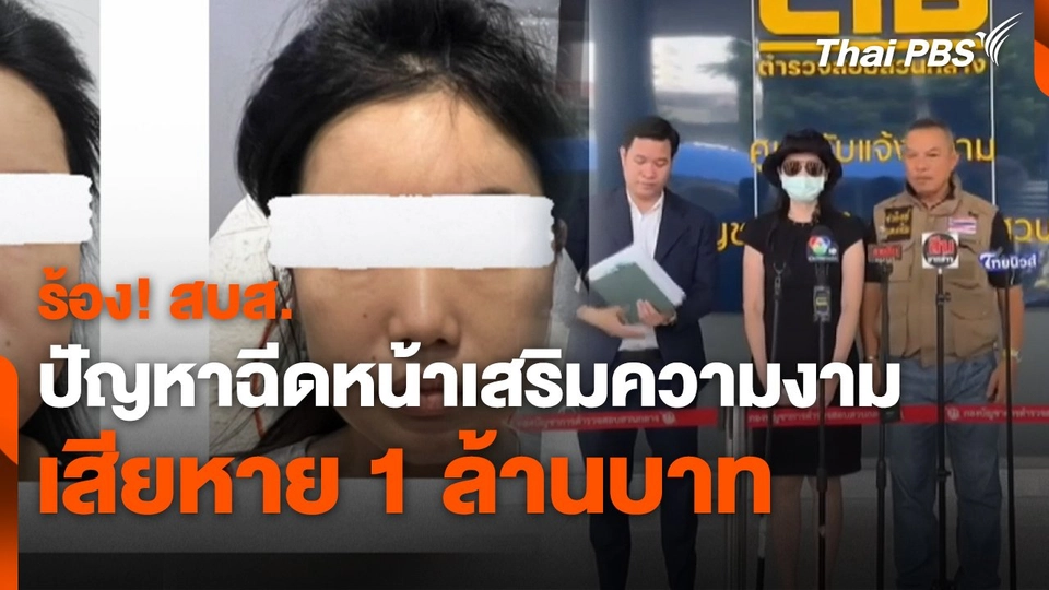 สถานีร้องเรียน : ร้อง! สบส. ปัญหาฉีดหน้าเสริมความงาม เสียหาย 1 ล้านบาท