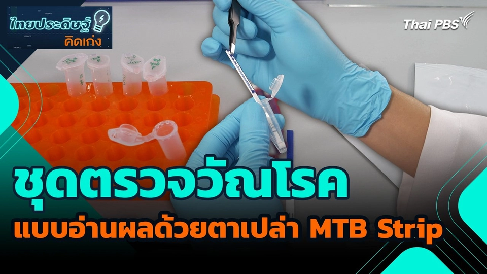 ไทยประดิษฐ์คิดเก่ง : ชุดตรวจวัณโรคแบบอ่านผลด้วยตาเปล่า MTB Strip