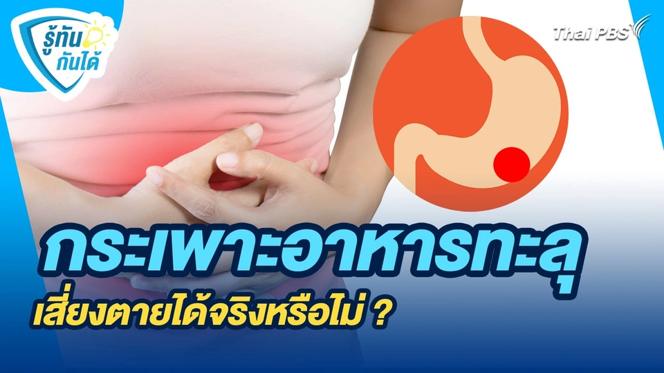 รู้ทันกันได้ : กระเพาะอาหารทะลุ เสี่ยงตายได้จริงหรือไม่ ?